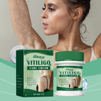 Vitiligo Cream – Restore Skin Pigmentation