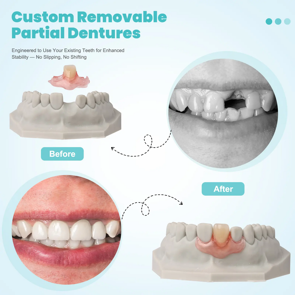 DIY Partial Denture Kit