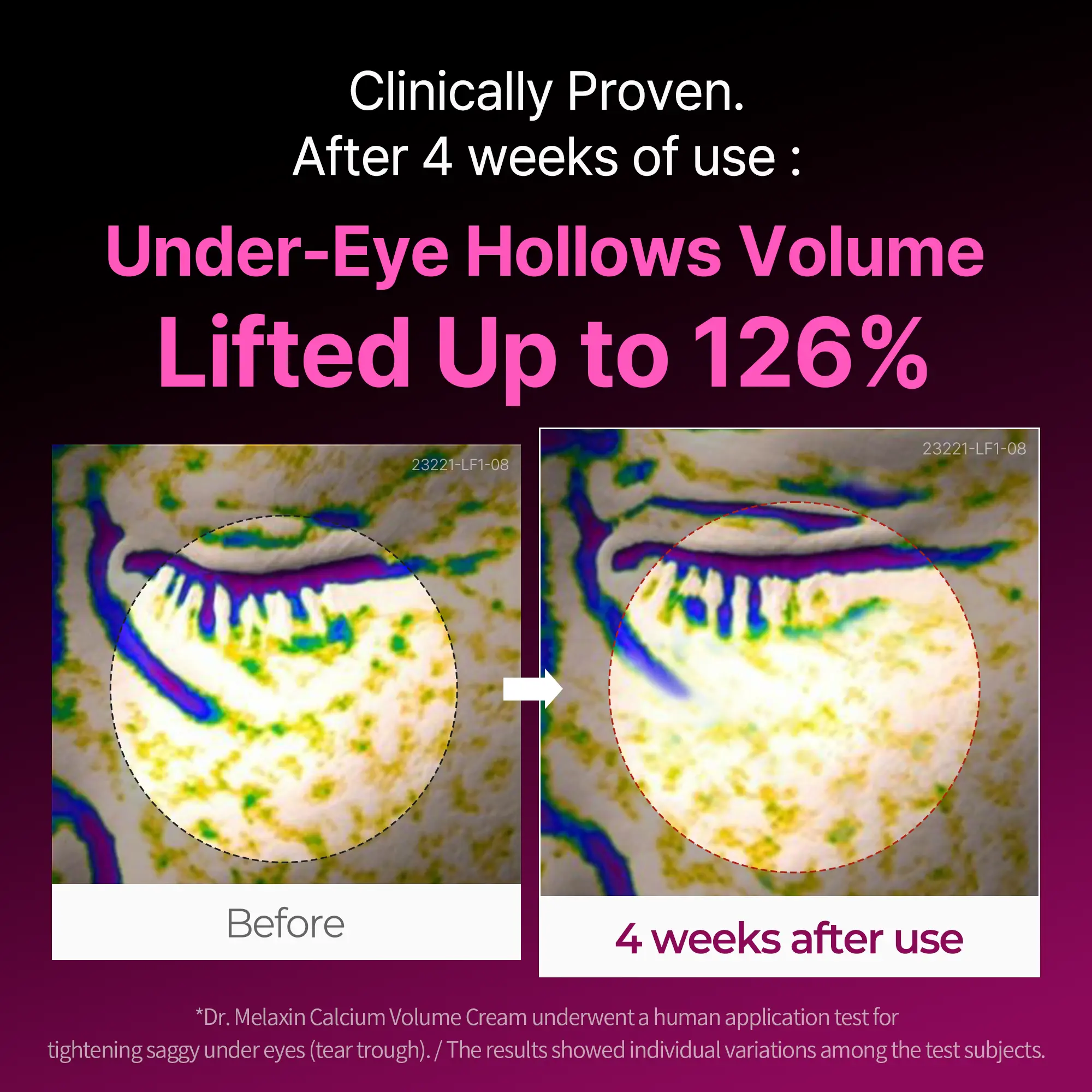 Calcium Volume Firming Cream