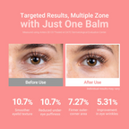Multi Balm Stick – 5-in-1 Korean Skincare Balm
