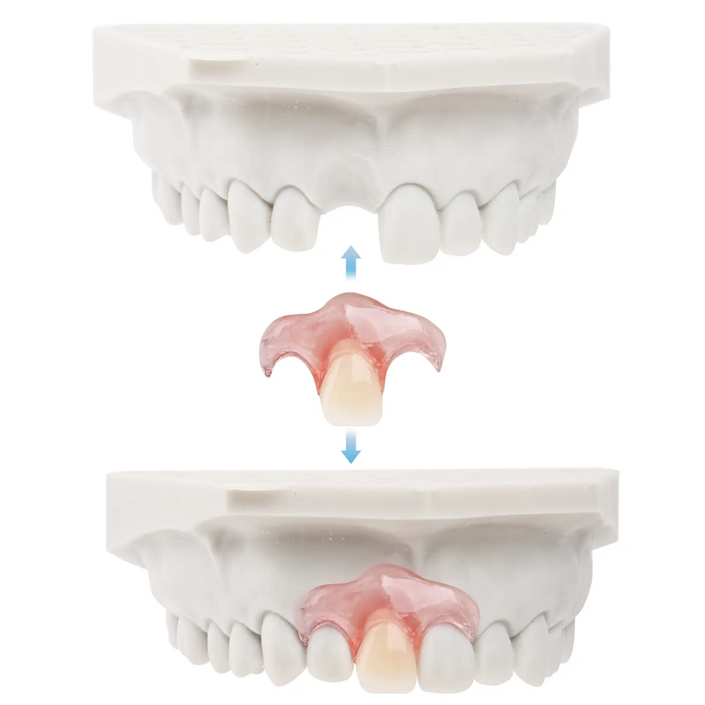 DIY Partial Denture Kit