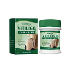 Vitiligo Cream – Restore Skin Pigmentation